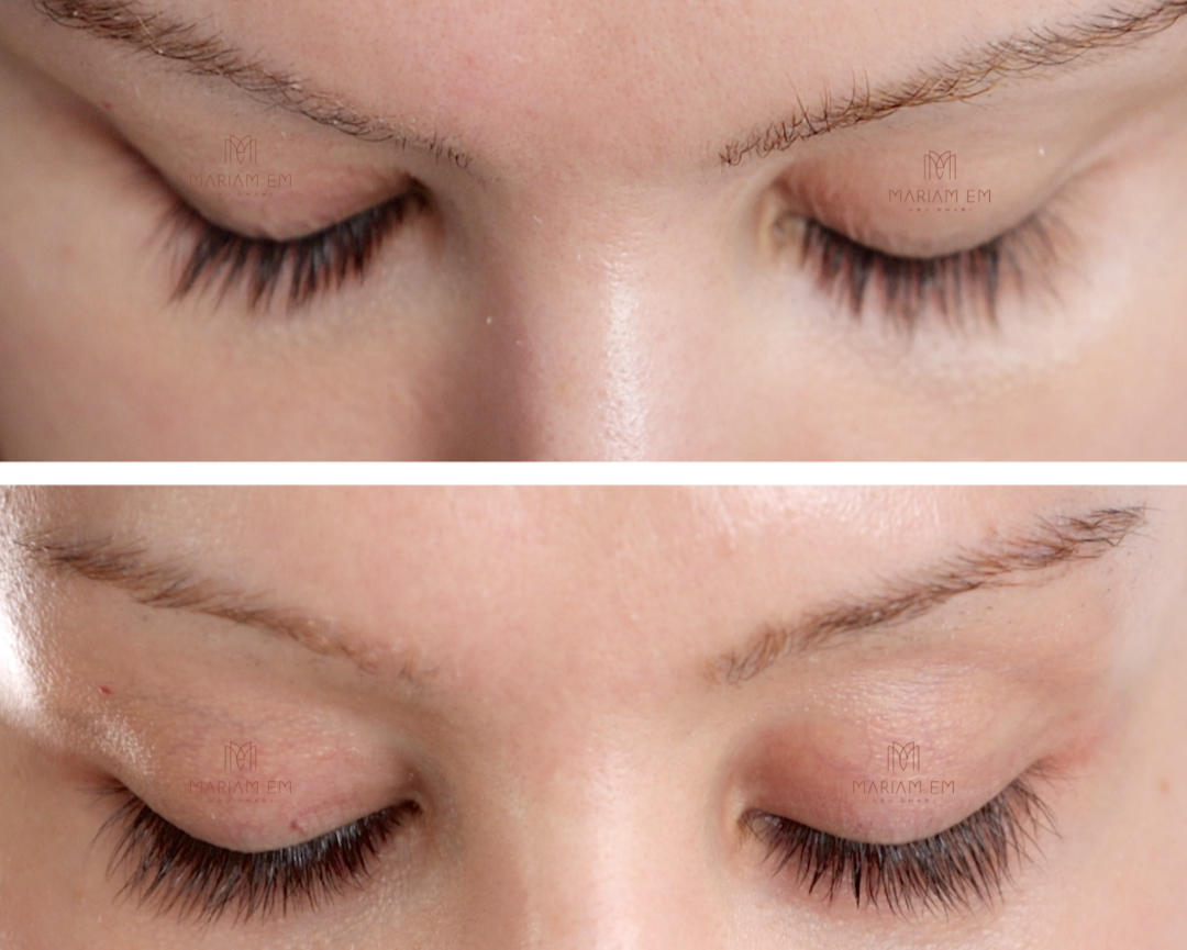 Eyelash & Brow Serum