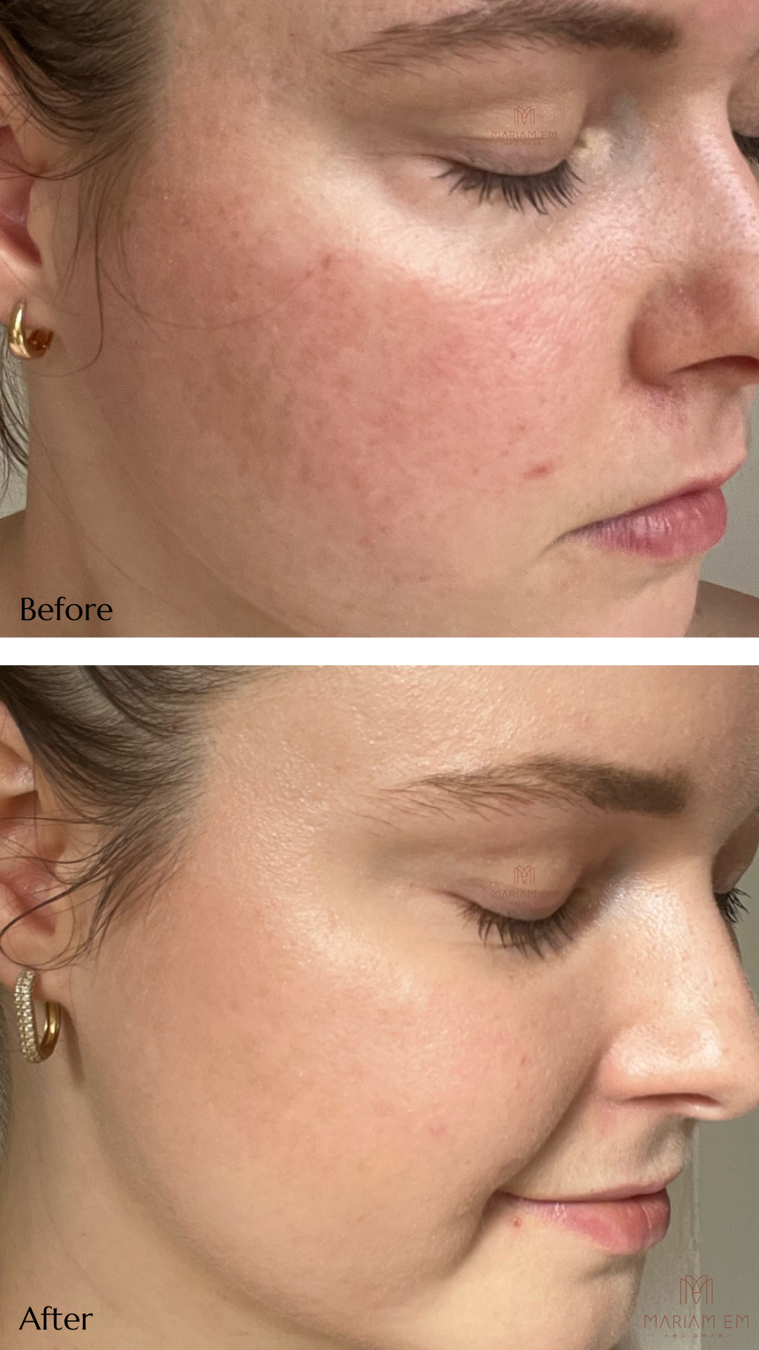 Balance & Soothe Face Serum