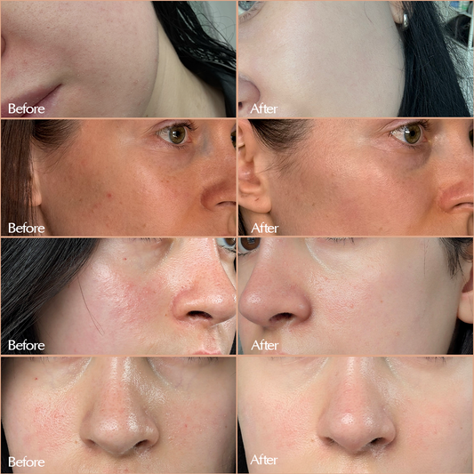 Balance & Soothe Face Serum