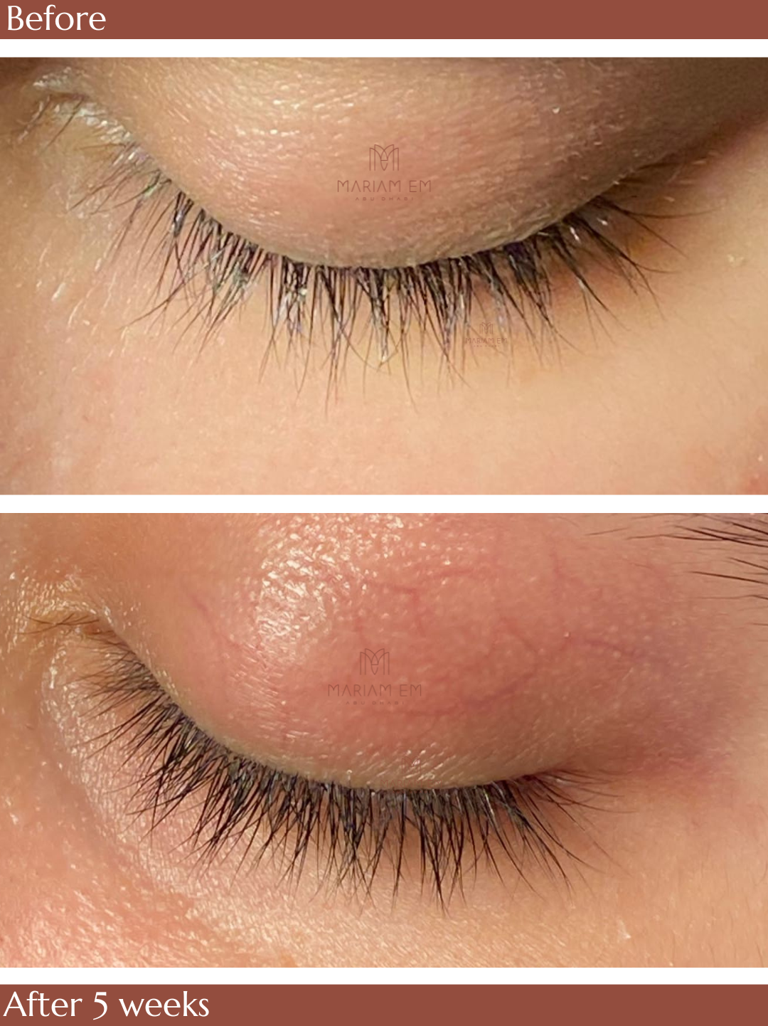 Eyelash & Brow Serum