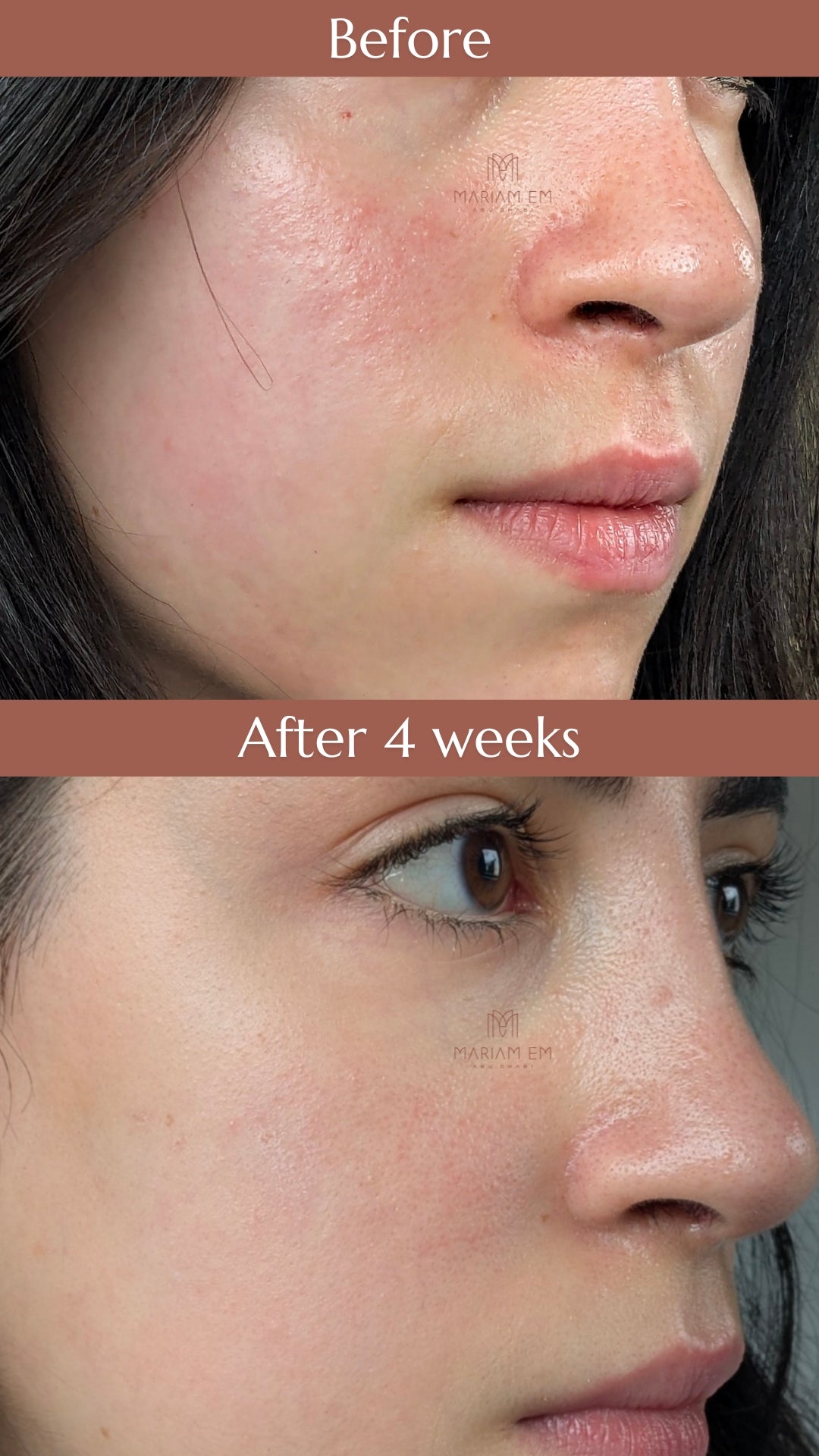 Balance & Soothe Face Serum