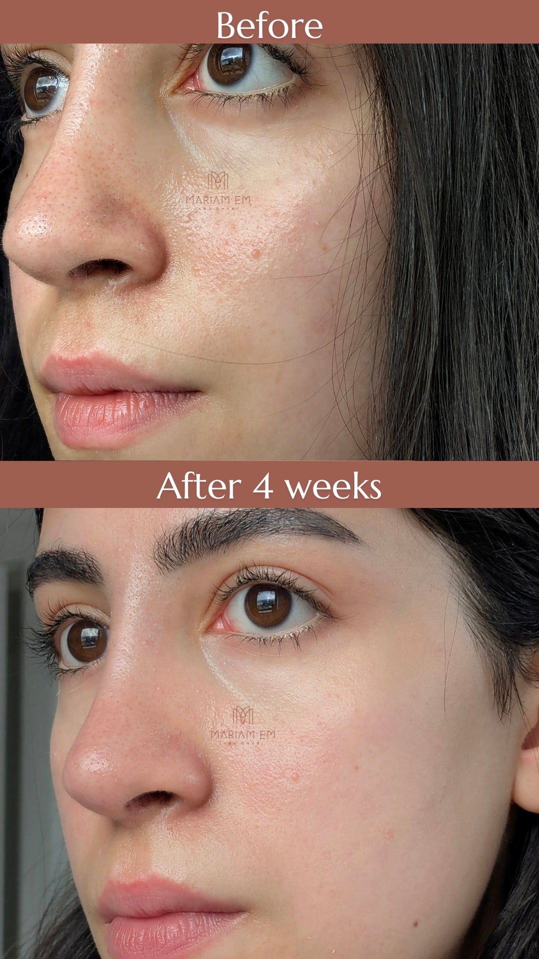 Balance & Soothe Face Serum