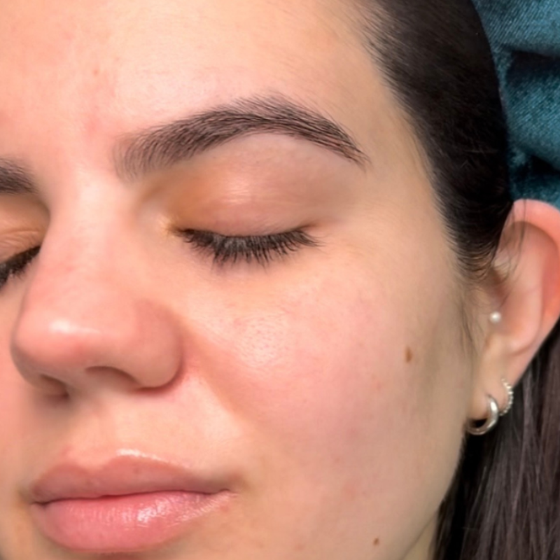 Before - 