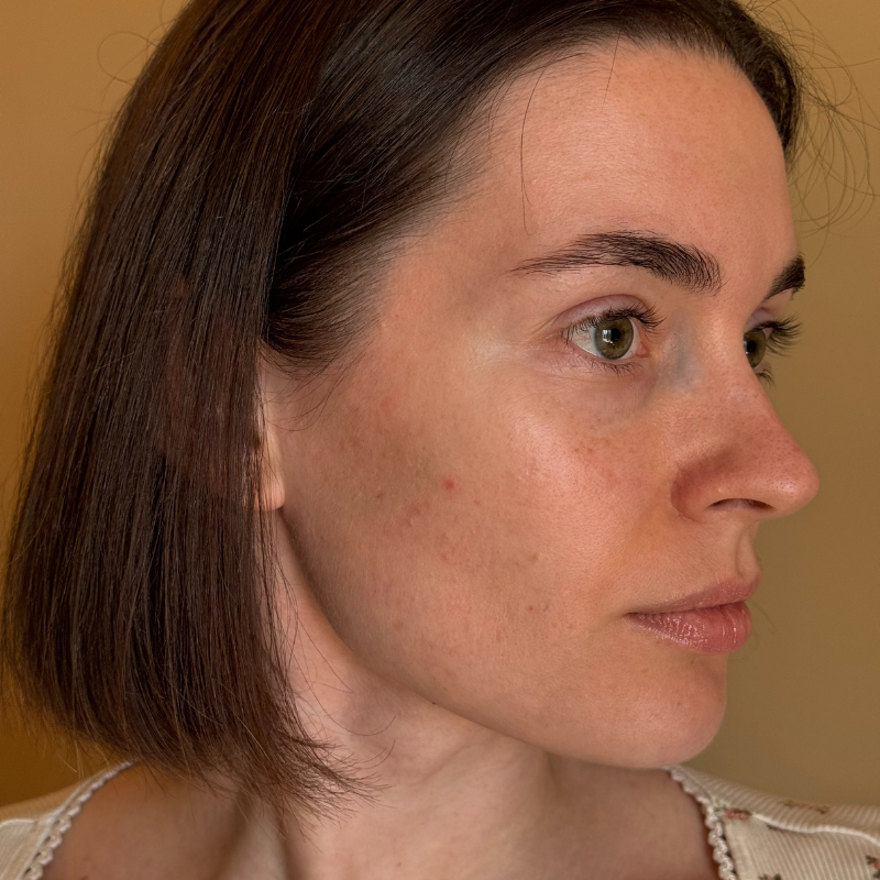Before - 